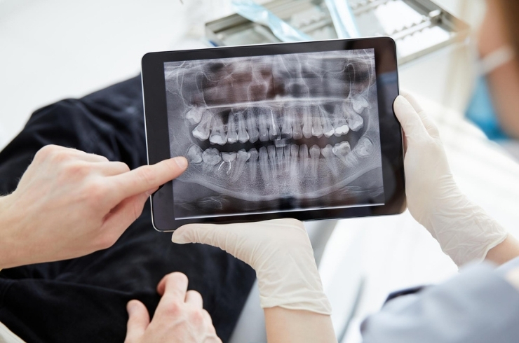 Advance dental technology