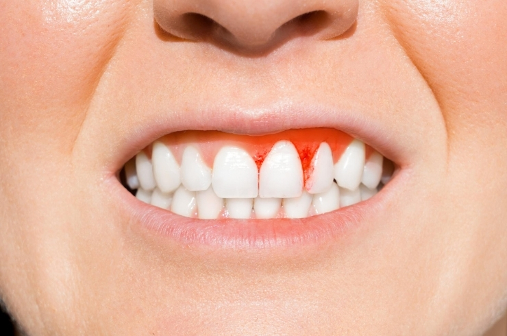 periodontics